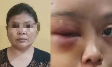 Sadis! Anak Yatim di Tarai Bangun di Aniaya Tante