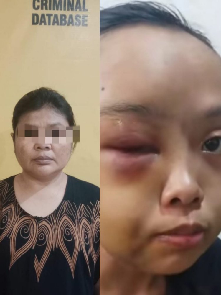 Sadis! Anak Yatim di Tarai Bangun di Aniaya Tante